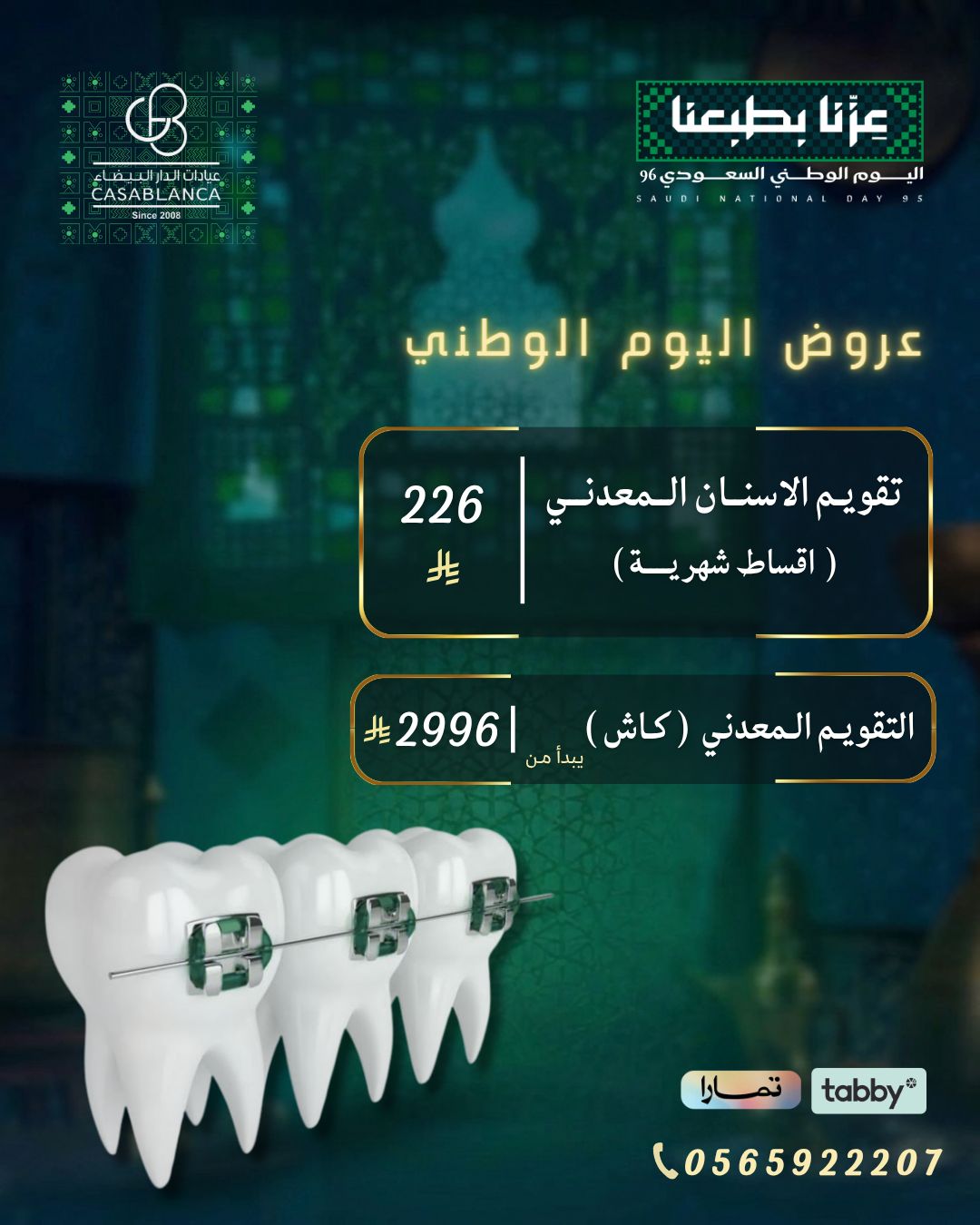 التقويم المعدني ( الاقساط )